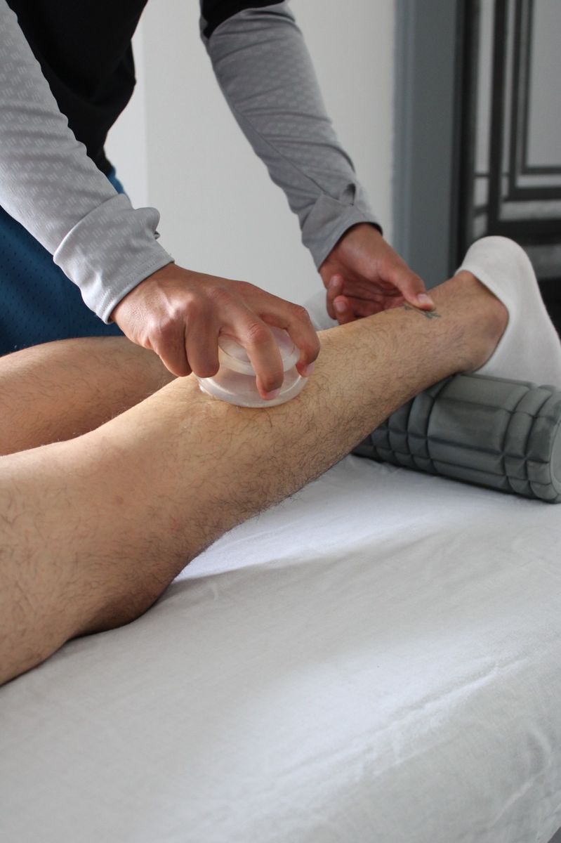 Dinamički cupping silikonskom čašicom na potkoljenici